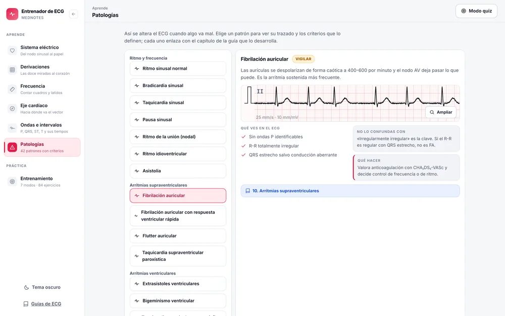 Captura de Entrenador de ECG